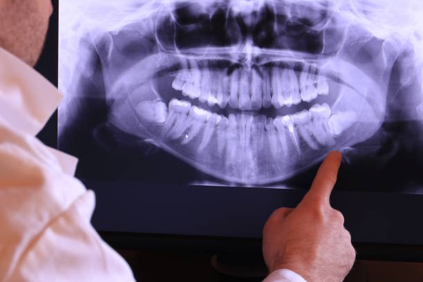 Best Emergency Treatment for Dental Infections or Abscesses in Savannah, MO